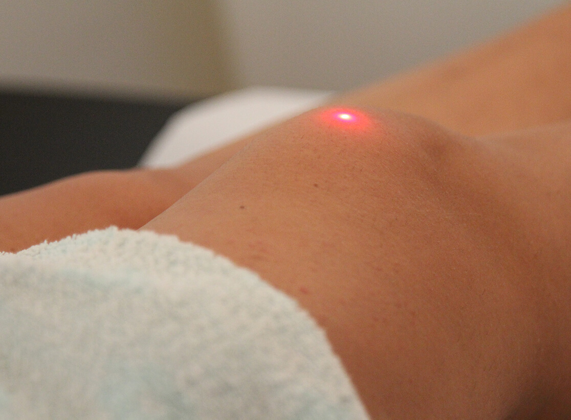 fisiocenter - laserterapia